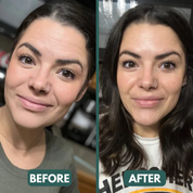 Navrada™ Silicone Beauty Patches