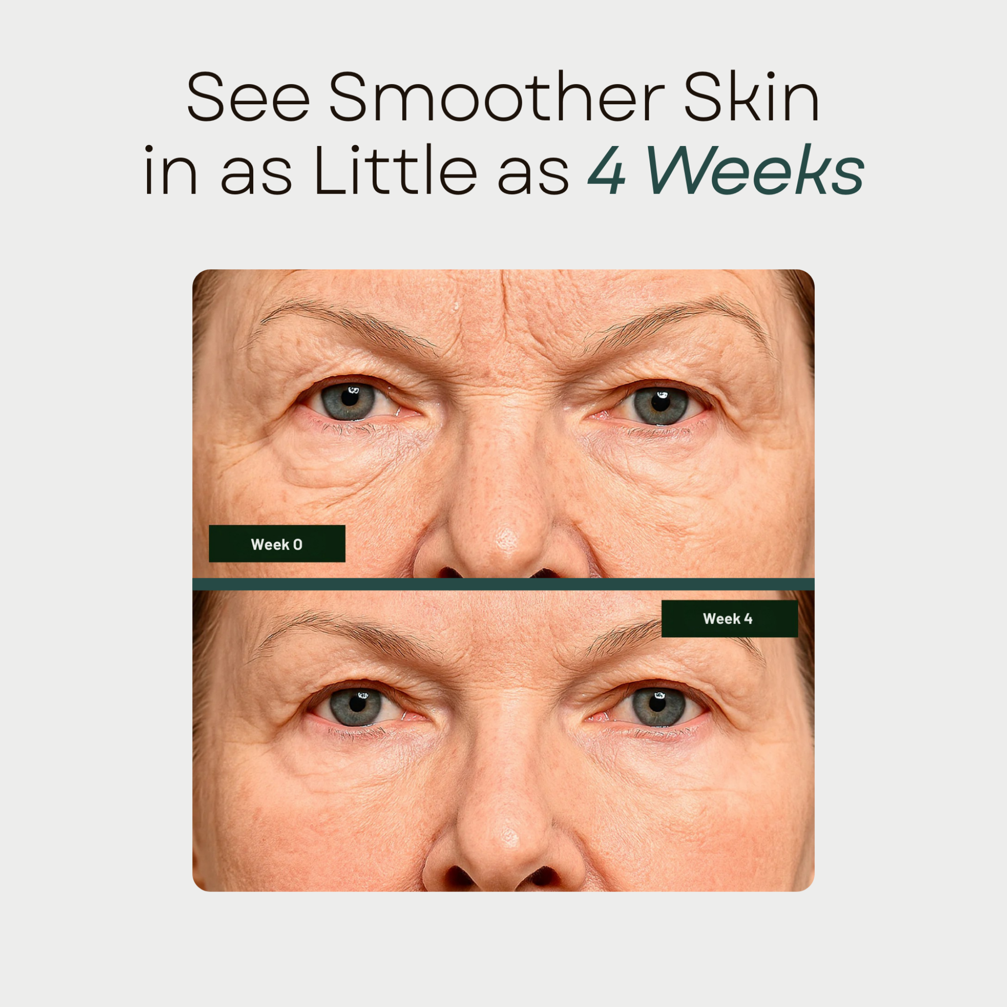 Navrada™ Silicone Beauty Patches